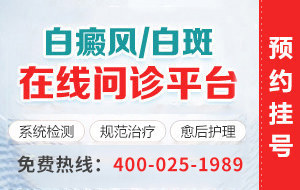 郑州银屑病医院